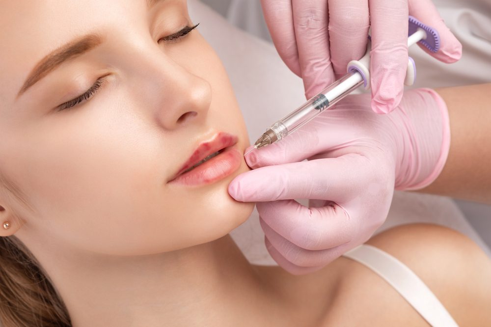 Lip Fillers in Saratoga Springs NY