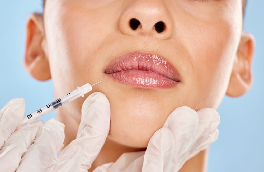 Best Lip Filler Injections in Upstate New York