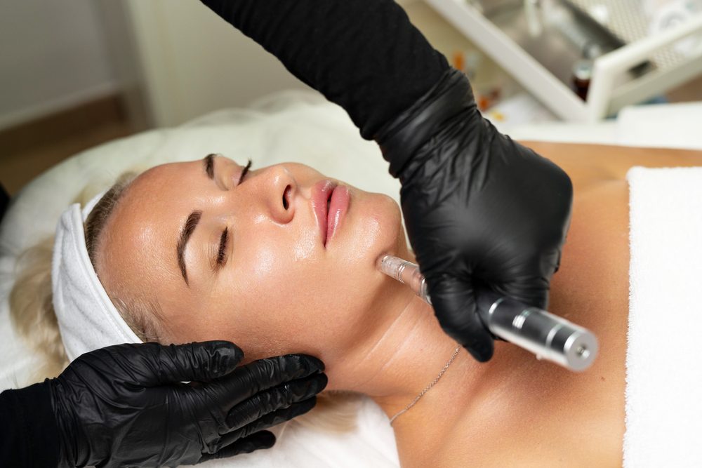 Best Microneedling Treatments in Albany, New York: FAQs and Answers