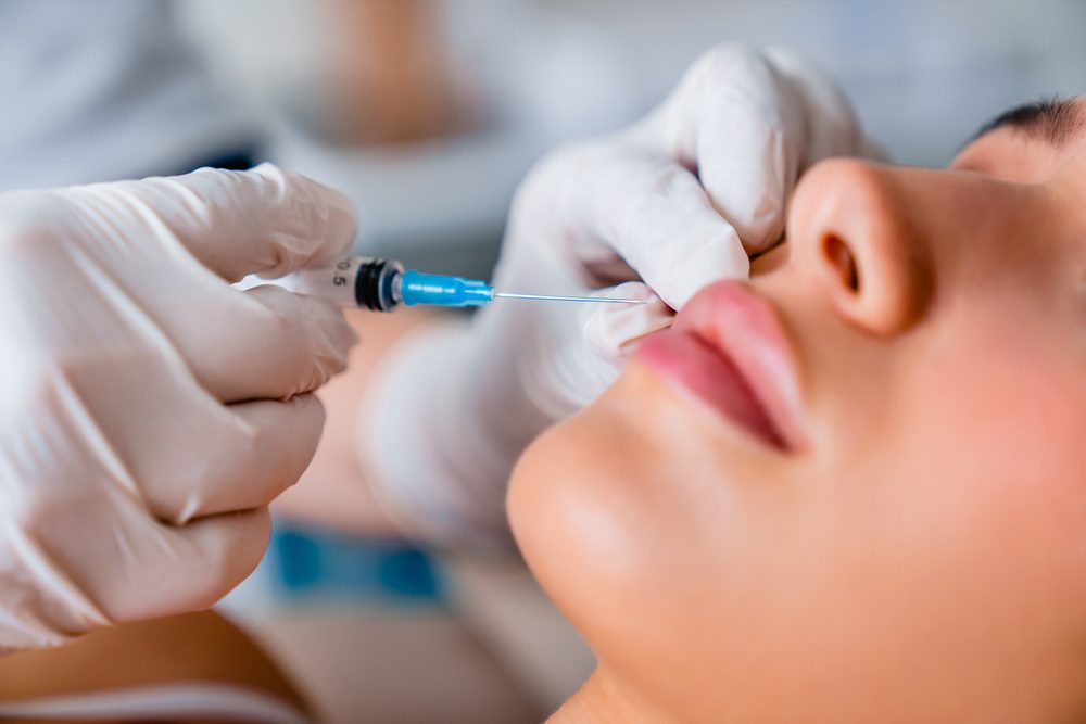 7 Foolproof Tips to the Best Lip Filler Results in Saratoga Springs New York